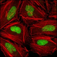 Figure 3: Confocal Immunofluorescence analysis of Hela cells using CHK2 mouse mAb (green), showing nuclear localization. Red: Actin filaments have been labeled with DY-554 phalloidin.