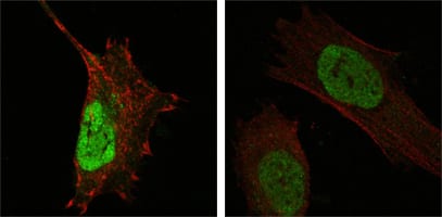 Figure 4: Confocal Immunofluorescence analysis of Hela (left) and L-02 (right) cells using MDM4 mouse mAb (green). Red: Actin filaments have been labeled with DY-554 phalloidin.