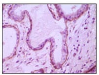 Figure 2: Immunohistochemical analysis of paraffin-embedded human breast ductal myoepithelium,showing cytoplasmic and membrane location with DAB staining using CD10 mouse mAb.