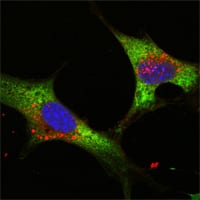 Figure 3: Confocal Immunofluorescence analysis of NTERA-2 cells using LIN28 mouse mAb (green). Blue: DRAQ5 fluorescent DNA dye.