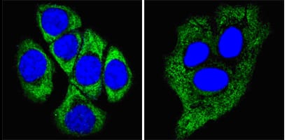 Figure 4: Confocal Immunofluorescence analysis of methanol-fixed ECA109 cells (left) and HepG2 cells (right) using CK8 mouse mAb (green), showing cytoplasmic localization. Blue: DRAQ5 fluorescent DNA dye.