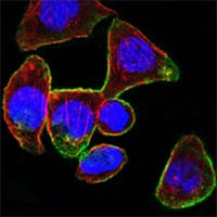 Figure 5: Confocal Immunofluorescence analysis of PANC-1 cells using CD44 mouse mAb (green). Red: Actin filaments have been labeled with DY-554 phalloidin. Blue: DRAQ5 fluorescent DNA dye.