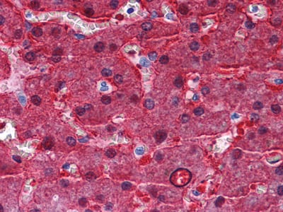 Figure 2: Immunohistochemical analysis of paraffin-embedded human Liver tissues using BHMT mouse mAb