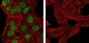 Figure 2: Confocal Immunofluorescence analysis of NTERA-2 cells (left) and HeLa cells (right) using Nanog mouse mAb (green). Red: Actin filaments have been labeled with DY-554 phalloidin.