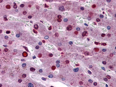 Figure 2: Immunohistochemical analysis of paraffin-embedded human Liver tissues using STAT3 mouse mAb