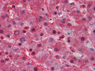 Figure 2: Immunohistochemical analysis of paraffin-embedded human Liver tissues using LPA mouse mAb