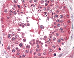 Figure 2: Immunohistochemical analysis of paraffin-embedded human testis tissues using BRAF mouse mAb.