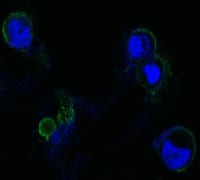 Figure 2: Confocal Immunofluorescence analysis of methanol-fixed HEK293 cells trasfected with FGFR4-hIgGFc using FGFR4 mouse mAb(green), showing membrane localization. Blue: DRAQ5 fluorescent DNA dye.