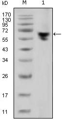 Figure 1: Western blot analysis using human IgG (Fc specific) mouse mAb against human serum (1).