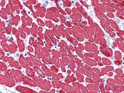 Figure 2: Immunohistochemical analysis of paraffin-embedded human Heart tissues using MYL3 mouse mAb.