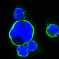 Figure 3: Confocal Immunofluorescence analysis of HEK293 cells trasfected with full-length ISL1-hIgGFc using ISL1 mouse mAb (green). Blue: DRAQ5 fluorescent DNA dye.