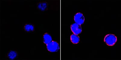 Figure 2: Confocal Immunofluorescence analysis of BCBL-1 cells (left) and L1210 cells (right) using CD18 mouse mAb (red). Blue: DRAQ5 fluorescent DNA dye.