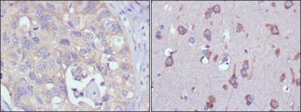 Figure 1: Immunohistochemical analysis of paraffin-embedded human lung cancer (left) and human brain (right) tissues using MPS1 mouse mAb with DAB staining.