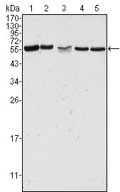 Figure 1: Western blot analysis using PAK2 mouse mAb against Hela (1), Jurkat (2), A549 (3), HEK293 (4) and K562 (5) cell lysate.