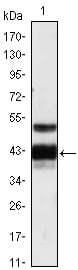 Figure 1: Western blot analysis using PROZ mouse mAb against human plasma (1).