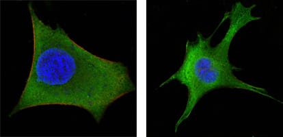 Figure3: Confocal Immunofluorescence analysis of Hela (left) and 3T3-L1 (right) cells using WNT1 mouse mAb (green). Red: Actin filaments have been labeled with DY-554 phalloidin. Blue: DRAQ5 fluorescent DNA dye.