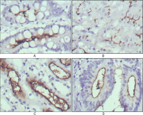 Figure 2: Immunohistochemical analysis of paraffin-embedded human normal stomach (A), normal liver (B), normal kidney (C) and rectum cancer tissues (D) using WNT10B mouse mAb with DAB staining.