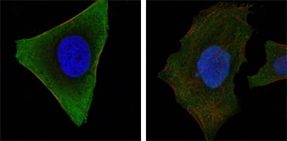 Figure 2: Confocal Immunofluorescence analysis of Hela (left) and HepG2 (right) cells using JAK3 mouse mAb (green). Red: Actin filaments have been labeled with DY-554 phalloidin. Blue: DRAQ5 fluorescent DNA dye.