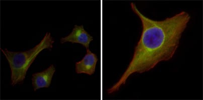 Figure 3: Immunofluorescence analysis of HepG2(left) and PACN-1 (right) cells using KRT15 mouse mAb (green). Red: Actin filaments have been labeled with DY-554 phalloidin. Blue: DRAQ5 fluorescent DNA dye.