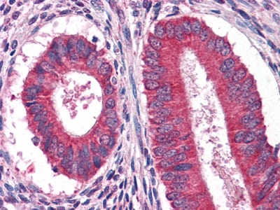 Figure 3: Immunohistochemical analysis of paraffin-embedded human Uterus tissues using anFtEG mouse mAb