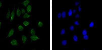 Figure 3: Immunofluorescence analysis of Hela cells using CHD3 mouse mAb (green). Blue: DRAQ5 fluorescent DNA dye.