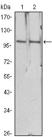 Figure 1: Western blot analysis using HDAC4 mouse mAb against Hela (1), Jurkat (2) cell lysate.