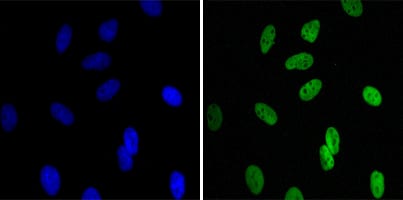 Figure 2: Immunofluorescence analysis of Hela cells using CBX1 mouse mAb (green). Blue: DRAQ5 fluorescent DNA dye.