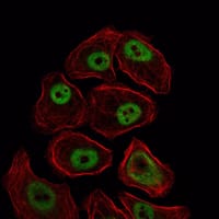 Figure 4: Immunofluorescence analysis of NIH/3T3 cells using SMC1 mouse mAb (green). Red: Actin filaments have been labeled with Alexa Fluor-555 phalloidin.