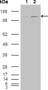 Figure 1: Western blot analysis using ABL2 mouse mAb against HEK293T cells transfected with the pCMV6-ENTRY control (1) and pCMV6-ENTRY ABL2 cDNA (2).