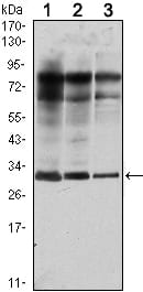 Figure 1: Western blot analysis using Rab25 mouse mAb against MCF-7 (1), T47D (2) and GC7901 (3) cell lysate.