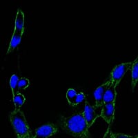 Figure 3: Immunofluorescence analysis of B16 cells using FAK mouse mAb (green). Blue: DRAQ5 fluorescent DNA dye.