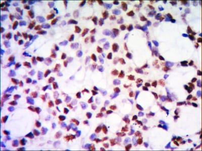 Figure 2: Immunohistochemical analysis of paraffin-embedded human kidney tissue using PP32 mouse mAb with DAB staining.