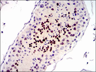 Figure 3: Immunohistochemical analysis of paraffin-embedded testis tissues using CDK4 mouse mAb with DAB staining.