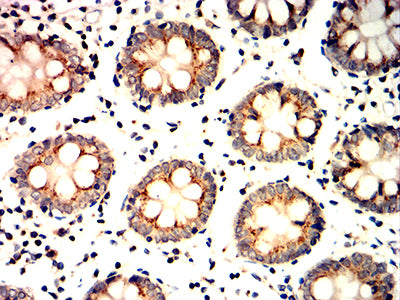 Figure 6:Immunohistochemical analysis of paraffin-embedded colon tissues using GOLGA2 mouse mAb with DAB staining.