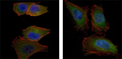 Figure 3: Immunofluorescence analysis of PANC-1 (left) and Hela (right) cells using AKT2 mouse mAb (green). Blue: DRAQ5 fluorescent DNA dye. Red: Actin filaments have been labeled with Alexa Fluor-555 phalloidin.