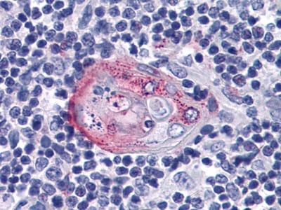 Figure 2: Immunohistochemical analysis of paraffin-embedded human Thymus tissues using anti-AKT2 mAb