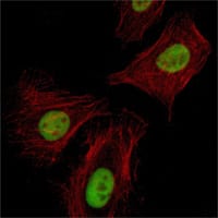 Figure 4: Immunofluorescence analysis of Hela cells using Pirh2 mouse mAb (green). Red: Actin filaments have been labeled with Alexa Fluor-555 phalloidin.