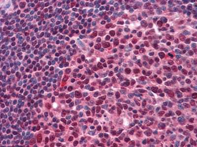 Figure 2: Immunohistochemical analysis of paraffin-embedded human Tonsil tissues using anti-Pirh2 mouse mAb