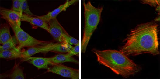 Figure 3: Immunofluorescence analysis of NIH/3T3 (left) and U251 (right) cells using GSK3B mouse mAb (green). Blue: DRAQ5 fluorescent DNA dye. Red: Actin filaments have been labeled with Alexa Fluor-555 phalloidin.