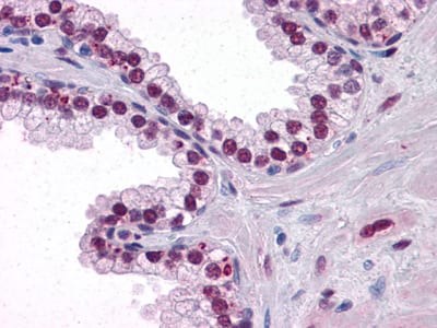 Figure 4: Immunohistochemical analysis of paraffin-embedded human Prostate tissues using Androgen receptor mouse mAb