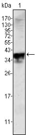 Figure 3: Western blot analysis using Androgen receptor mouse mAb against Androgen receptor (aa221-321)-hIgGFc transfected HEK293 cell lysate.