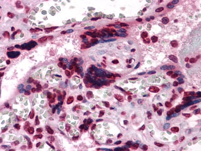 Figure 2: Immunohistochemical analysis of paraffin-embedded human Placenta tissues using anti-CSF1 mouse mAb