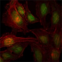 Figure 3: Immunofluorescence analysis of Hela cells using ZBTB7B mouse mAb (green). Red: Actin filaments have been labeled with Alexa Fluor-555 phalloidin