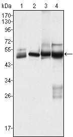 Figure 1: Western blot analysis using CK7 mouse mAb against Hela (1), MCF-7 (2), A431 (3) and A549 (4) cell lysate.