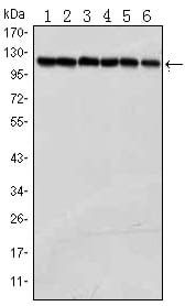 Figure 1: Western blot analysis using PARP mouse mAb against Jurkat (1), K562 (2), Hela (3), Raji (4),THP-1 (5) and SW620 (6) cell lysate.