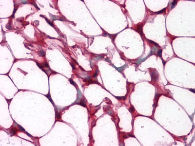 Figure 2: Immunohistochemical analysis of paraffin-embedded human Colon, Adipocytes tissues using anti-ETS1 mouse mAb