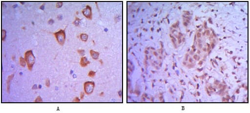 Figure 2: Immunohistochemical analysis of paraffin-embedded human brain tissue (A) and breast tumor (B) uing ETS1 mouse mAb.