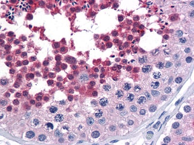 Figure 2: Immunohistochemical analysis of paraffin-embedded human Testis tissues using anti-CDC25C mouse mAb