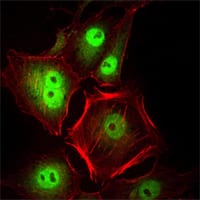 Figure 2: Immunofluorescence analysis of Hela cells using CDC2 mouse mAb (green). Red: Actin filaments have been labeled with Alexa Fluor-555 phalloidin.