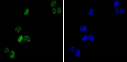 Figure 2: Immunofluorescence analysis of K562(left) cells using GATA1 mouse mAb (green). Blue: DRAQ5 fluorescent DNA dye.